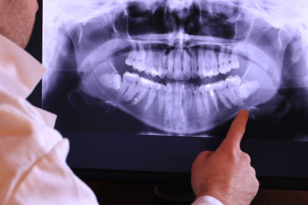 Best Urgent Tooth Repair  in Oskaloosa, KS