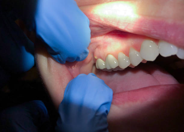 Best Dentist for Severe Toothache  in Oskaloosa, KS