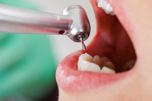 Best Root Canal Emergency Dentist  in Oskaloosa, KS